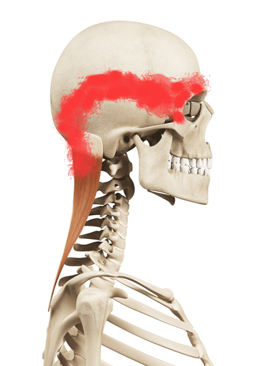COVID-19 & Headaches - The Work From Home Syndrome